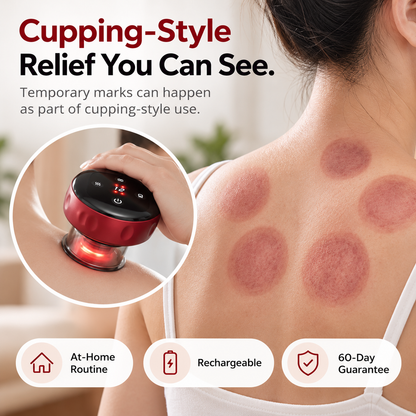 ReleaseCup cupping-style use showing temporary circular marks that can occur after use.